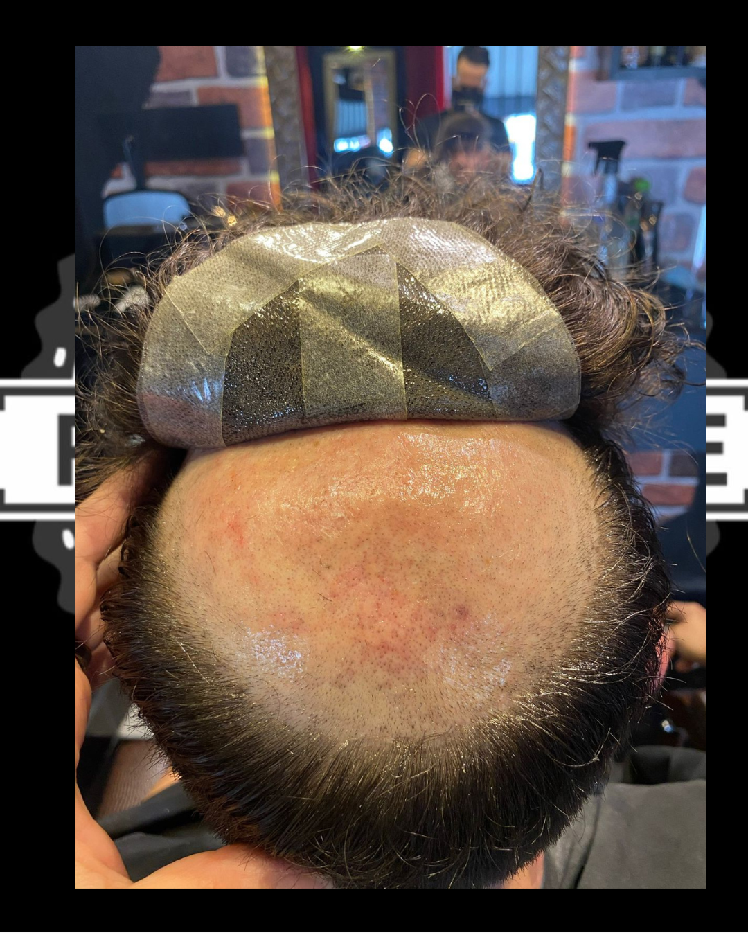 Processo de Aplicação